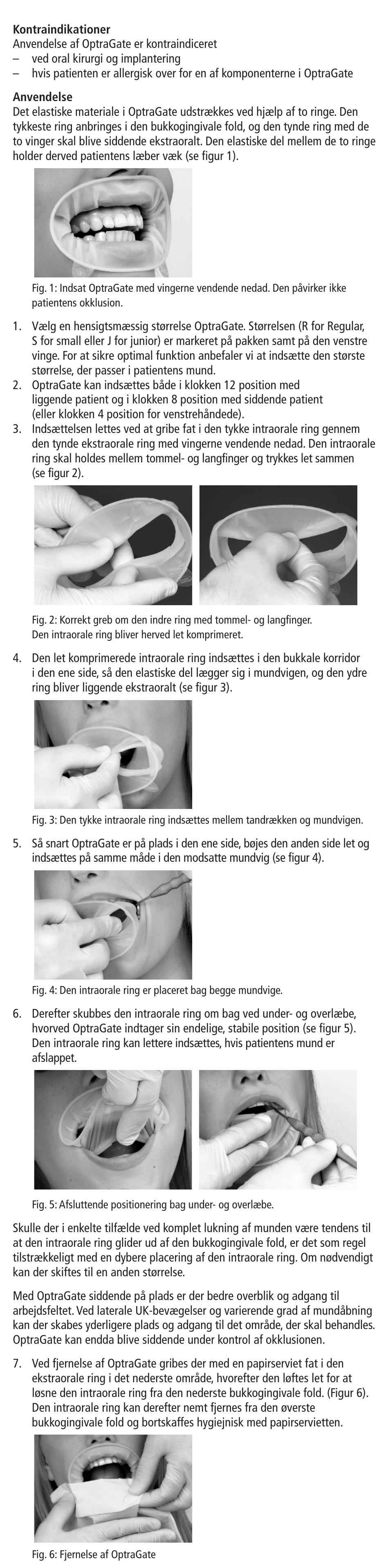 Ivoclar Vivadent OptraGate User Manual | Page 13 / 48