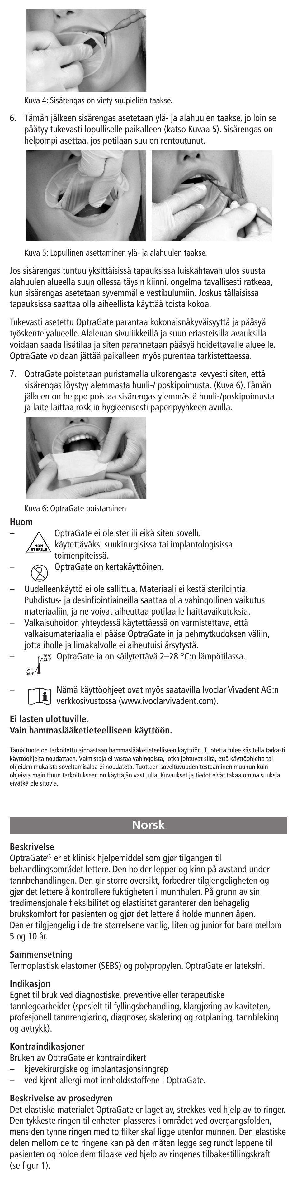 Norsk | Ivoclar Vivadent OptraGate User Manual | Page 15 / 48