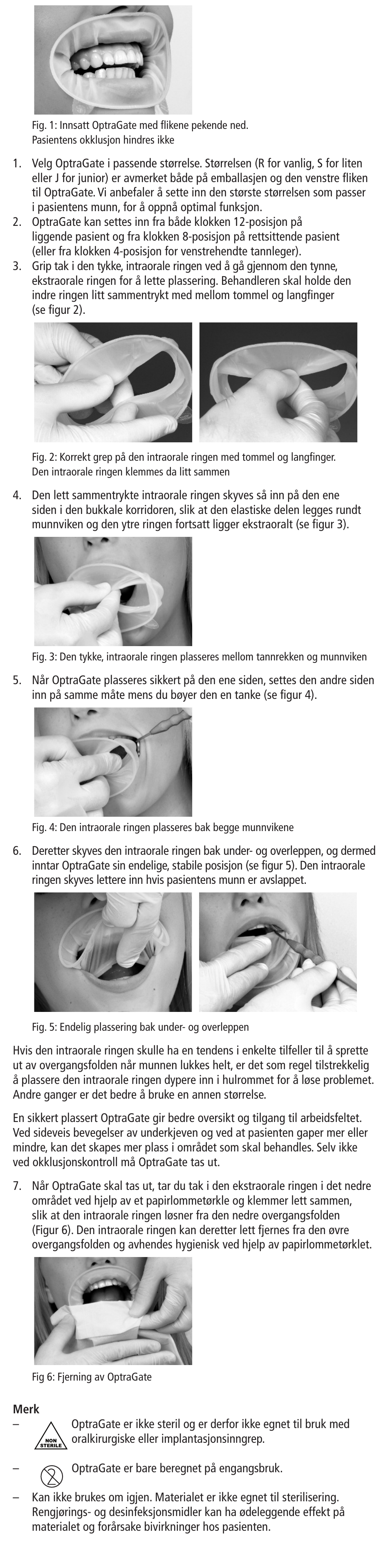 Ivoclar Vivadent OptraGate User Manual | Page 16 / 48