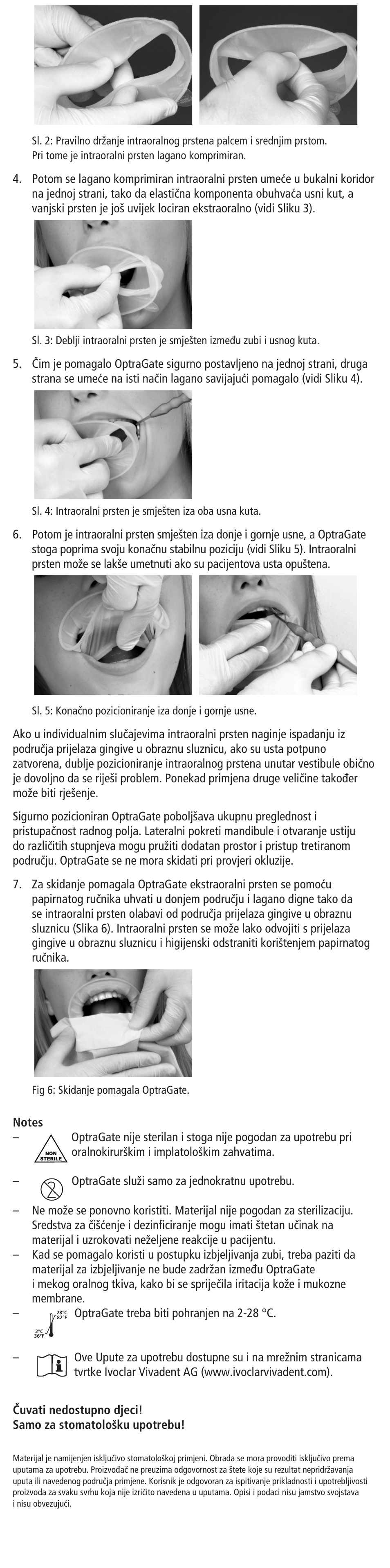 Ivoclar Vivadent OptraGate User Manual | Page 24 / 48