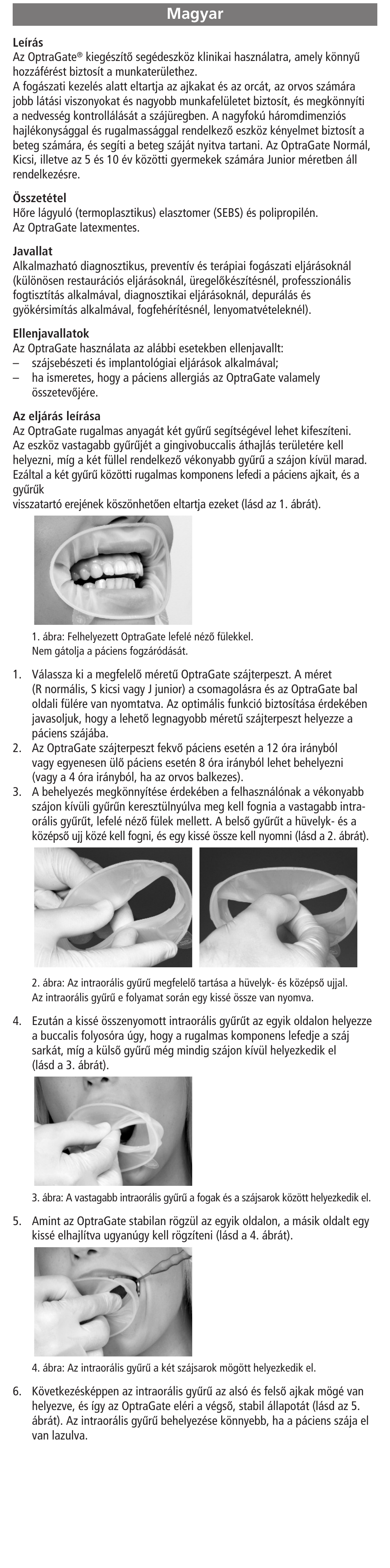 Magyar | Ivoclar Vivadent OptraGate User Manual | Page 28 / 48