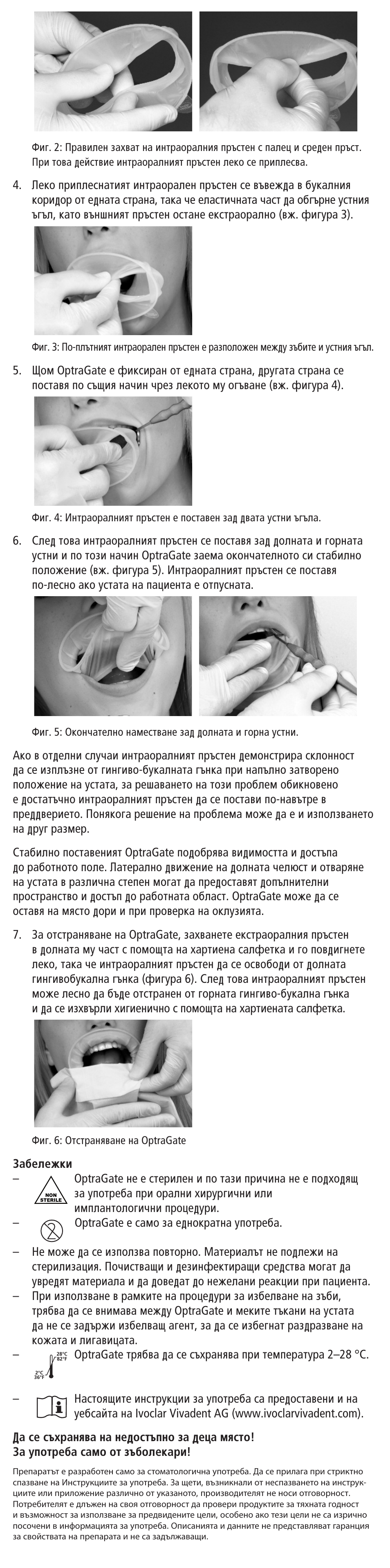 Ivoclar Vivadent OptraGate User Manual | Page 35 / 48