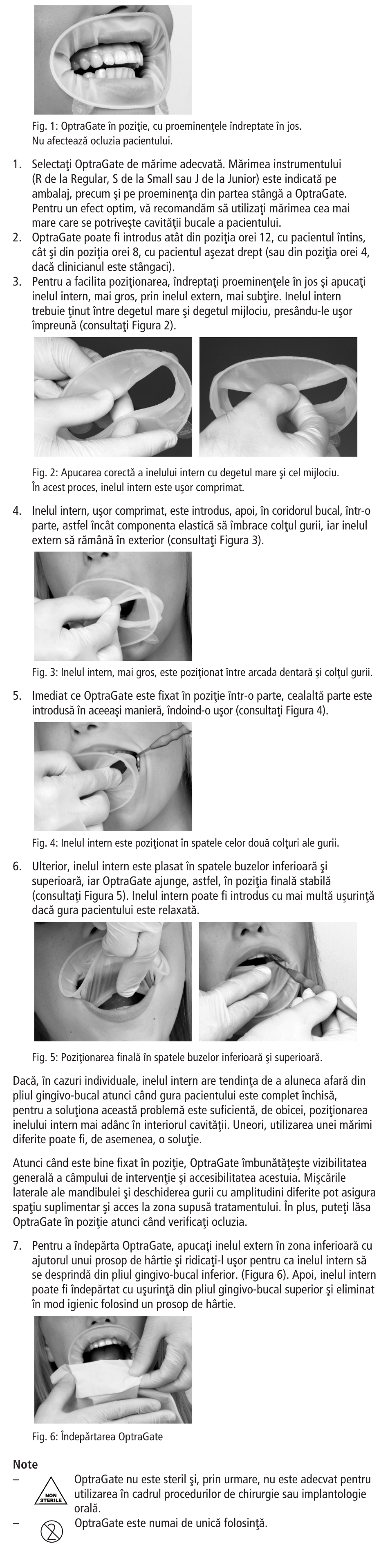 Ivoclar Vivadent OptraGate User Manual | Page 38 / 48
