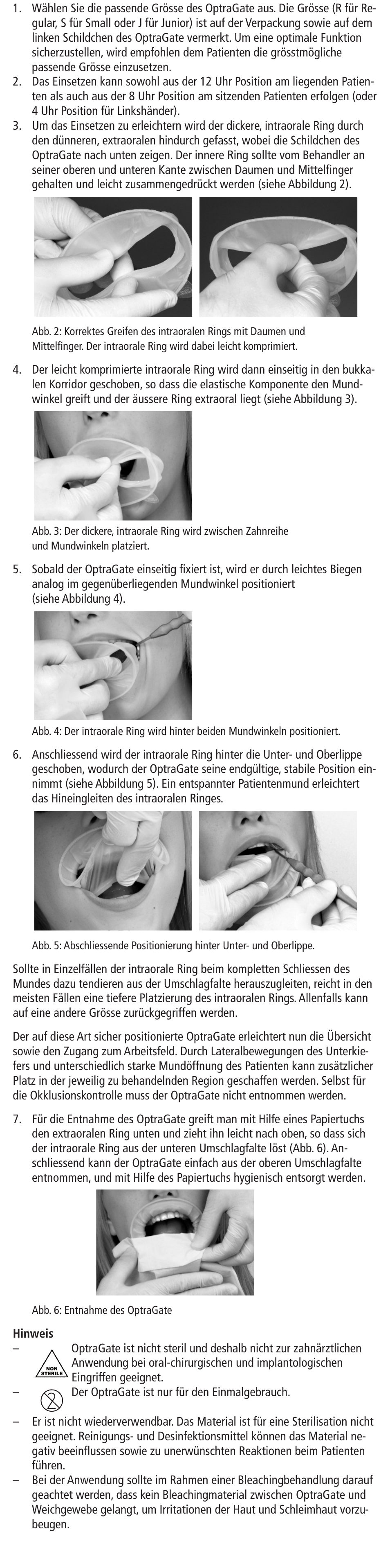 Ivoclar Vivadent OptraGate User Manual | Page 4 / 48