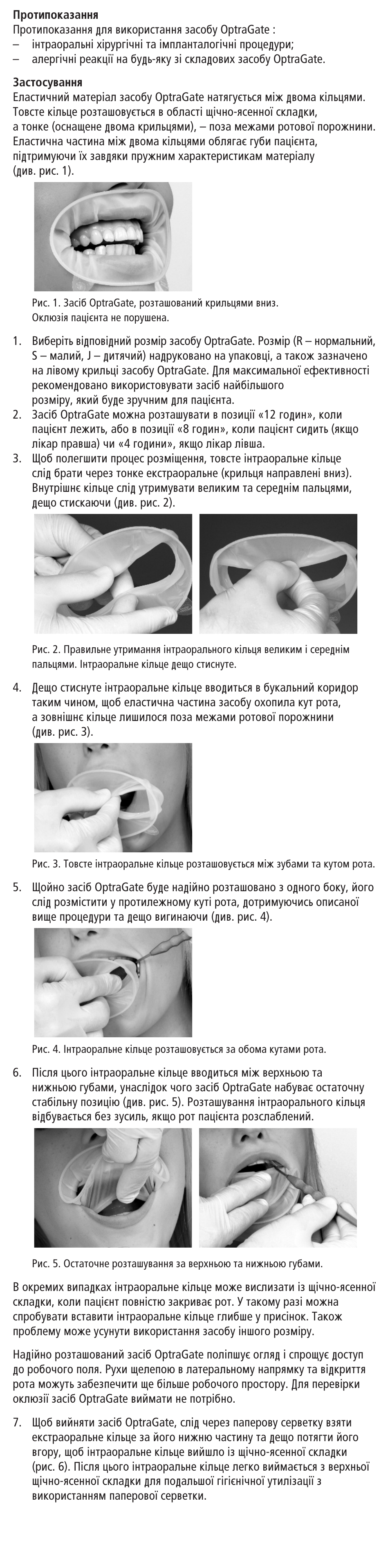 Ivoclar Vivadent OptraGate User Manual | Page 41 / 48