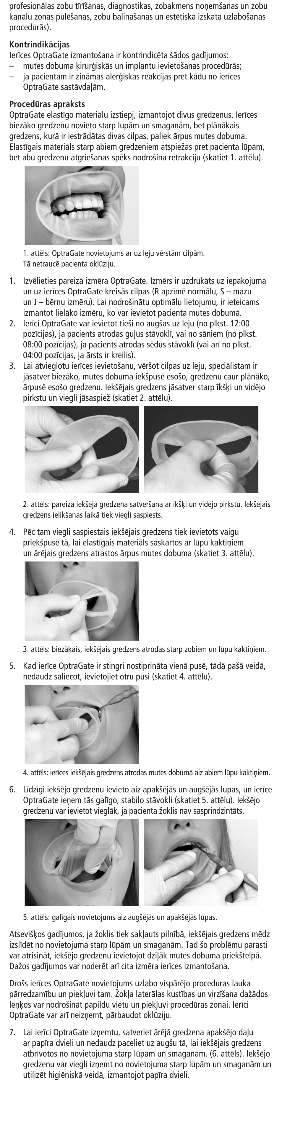 Ivoclar Vivadent OptraGate User Manual | Page 44 / 48