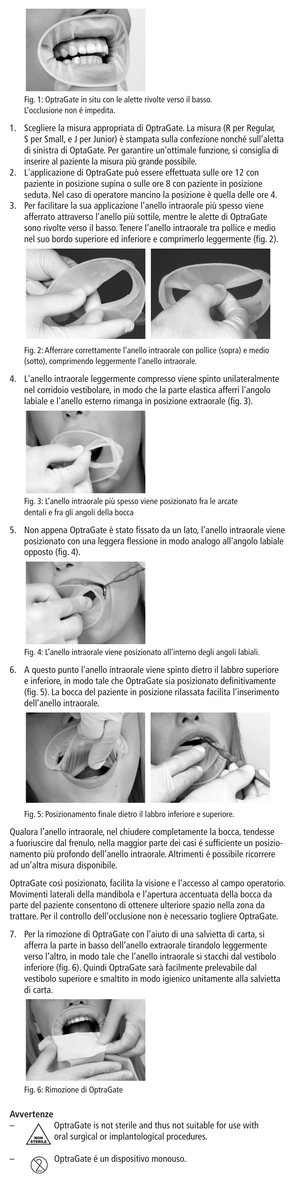 Ivoclar Vivadent OptraGate User Manual | Page 7 / 48