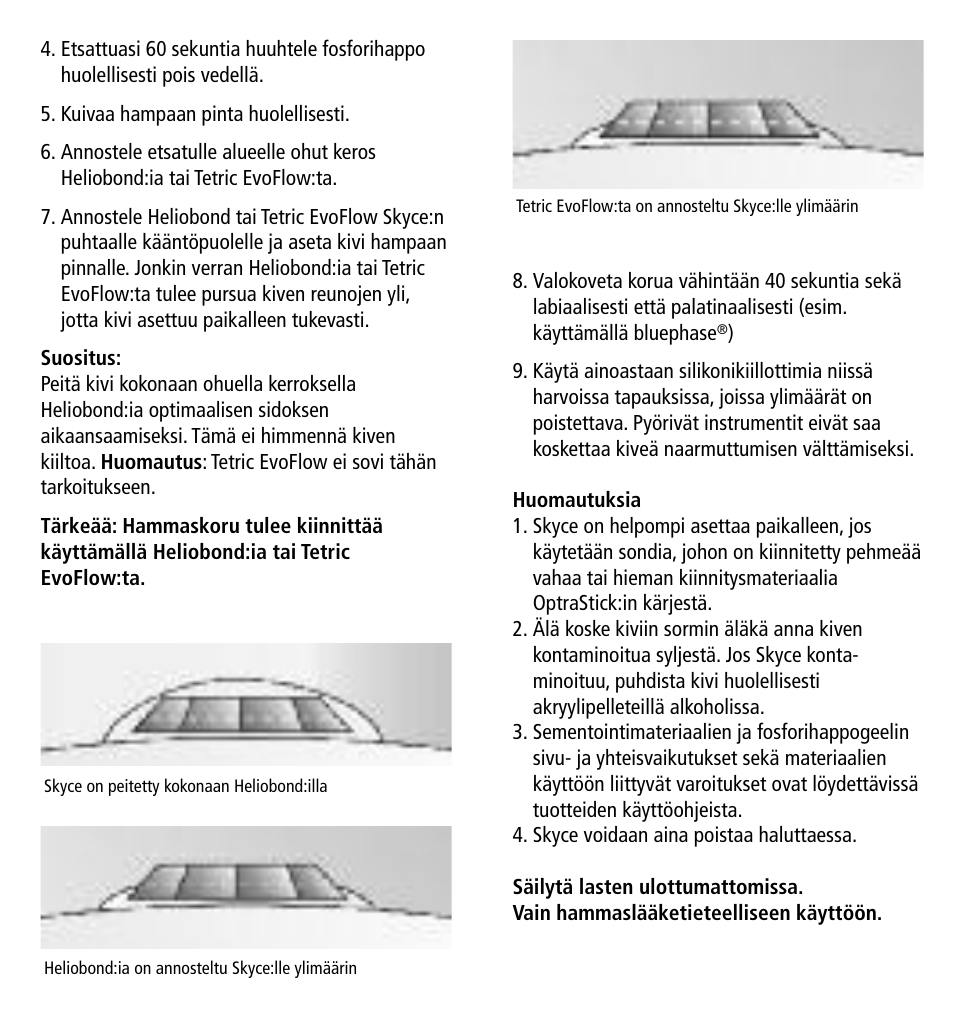 Ivoclar Vivadent Skyce User Manual | Page 18 / 26