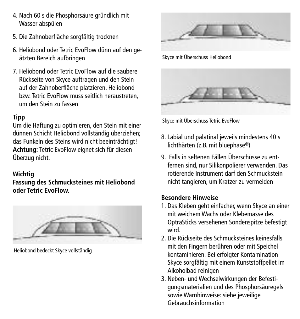 Ivoclar Vivadent Skyce User Manual | Page 4 / 26
