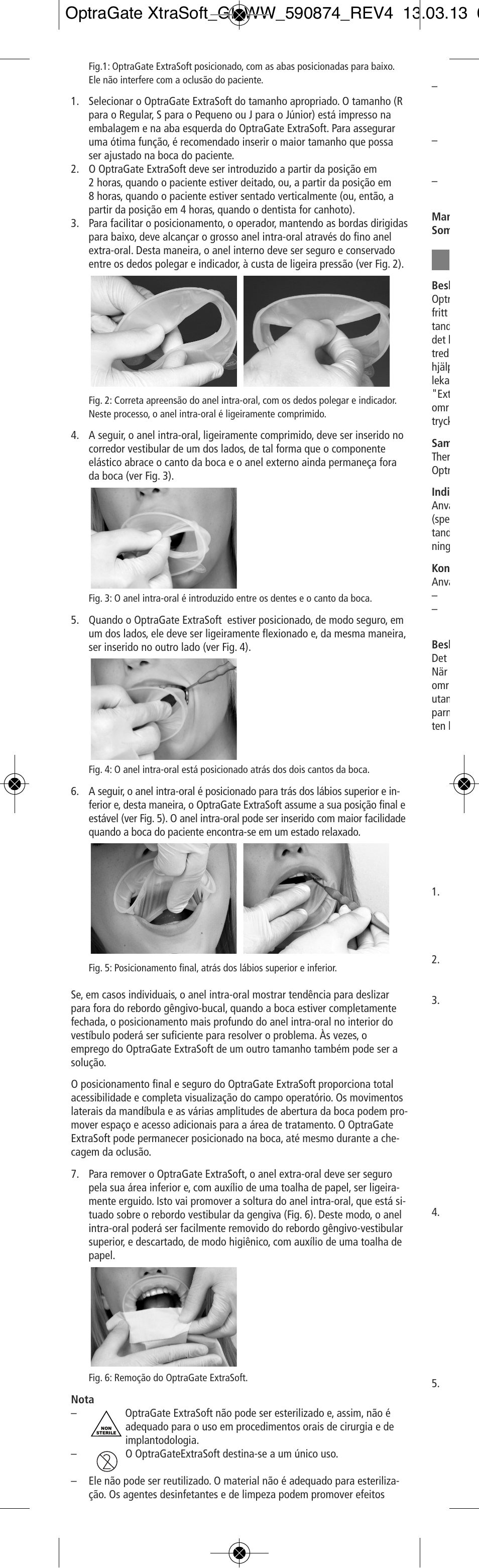 Ivoclar Vivadent OptraGate ExtraSoft Version User Manual | Page 10 / 48
