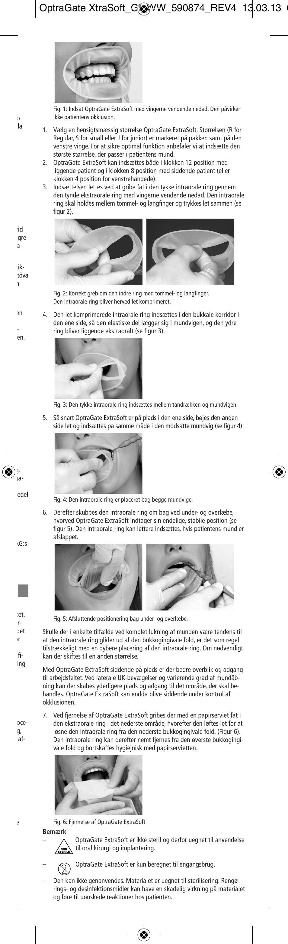 Ivoclar Vivadent OptraGate ExtraSoft Version User Manual | Page 13 / 48