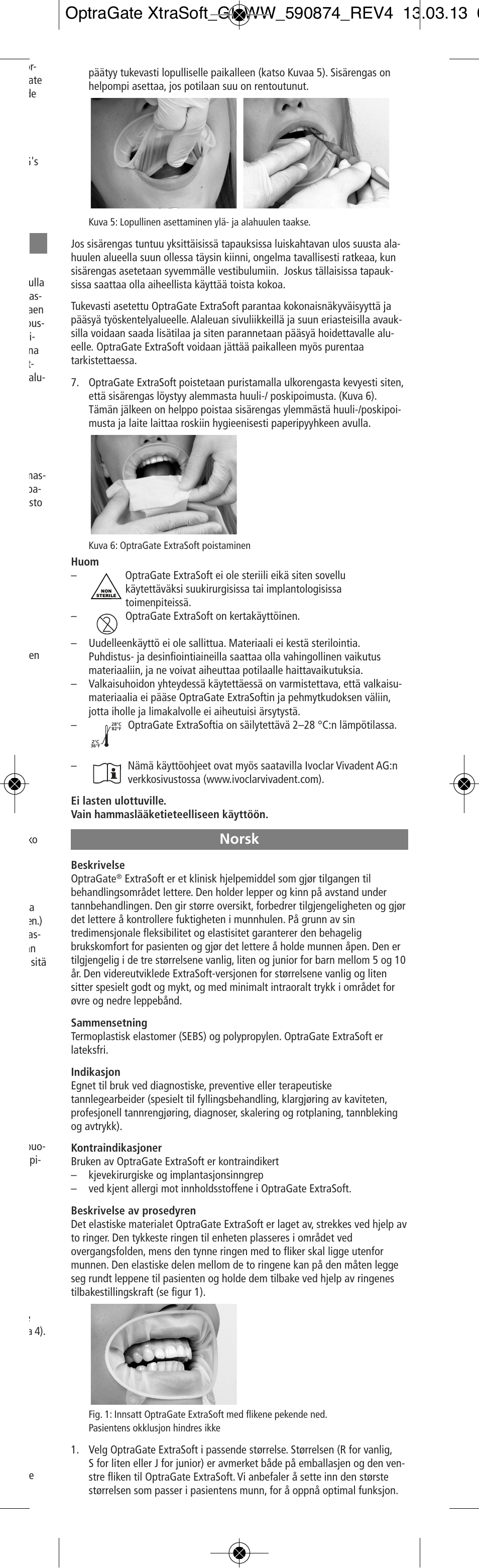 Norsk | Ivoclar Vivadent OptraGate ExtraSoft Version User Manual | Page 15 / 48