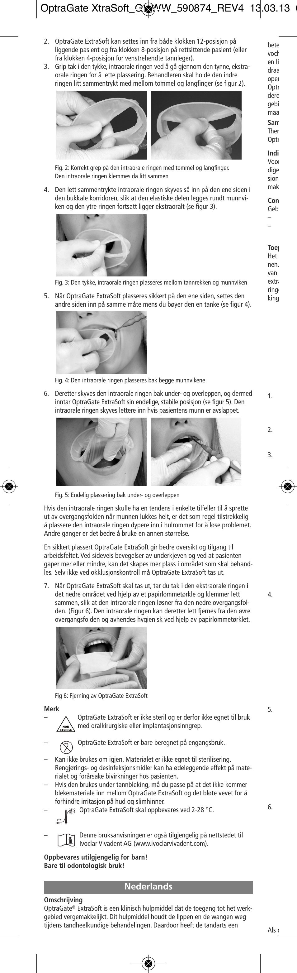 Nederlands | Ivoclar Vivadent OptraGate ExtraSoft Version User Manual | Page 16 / 48