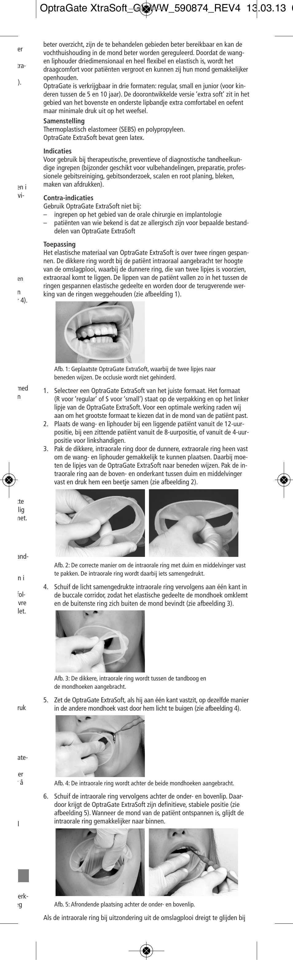Ivoclar Vivadent OptraGate ExtraSoft Version User Manual | Page 17 / 48