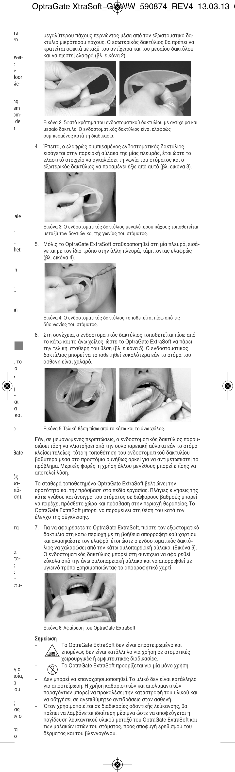 Ivoclar Vivadent OptraGate ExtraSoft Version User Manual | Page 19 / 48