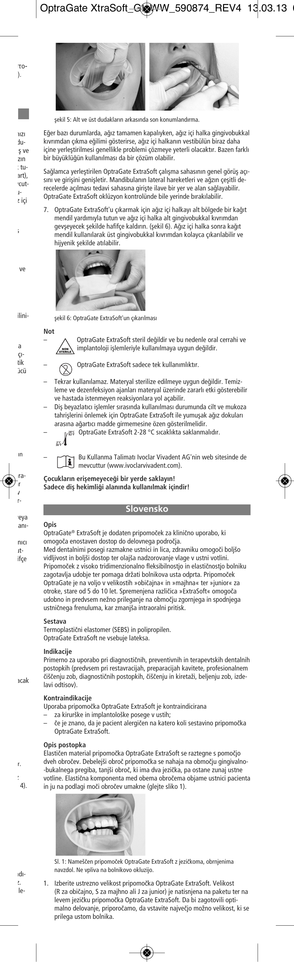 Slovensko | Ivoclar Vivadent OptraGate ExtraSoft Version User Manual | Page 21 / 48