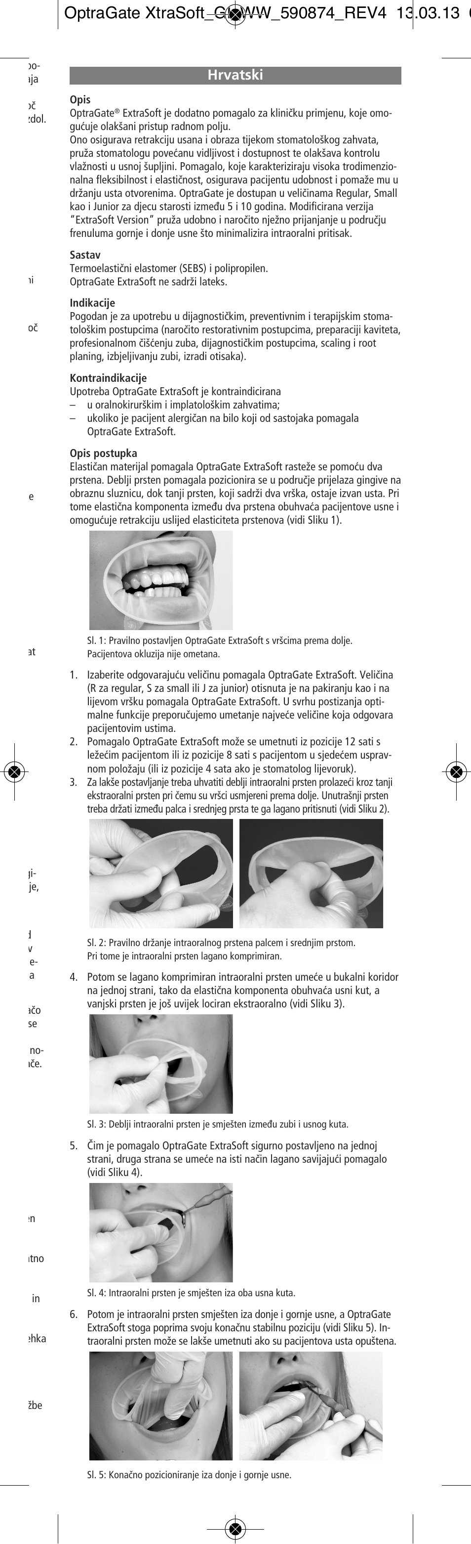 Hrvatski | Ivoclar Vivadent OptraGate ExtraSoft Version User Manual | Page 23 / 48