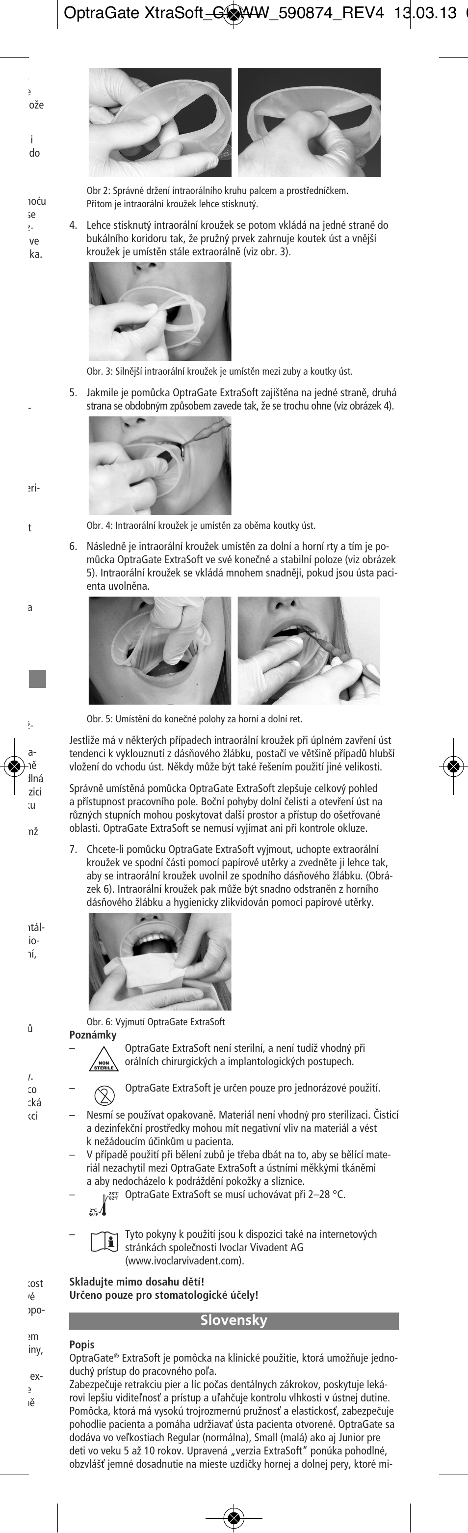 Slovensky | Ivoclar Vivadent OptraGate ExtraSoft Version User Manual | Page 25 / 48