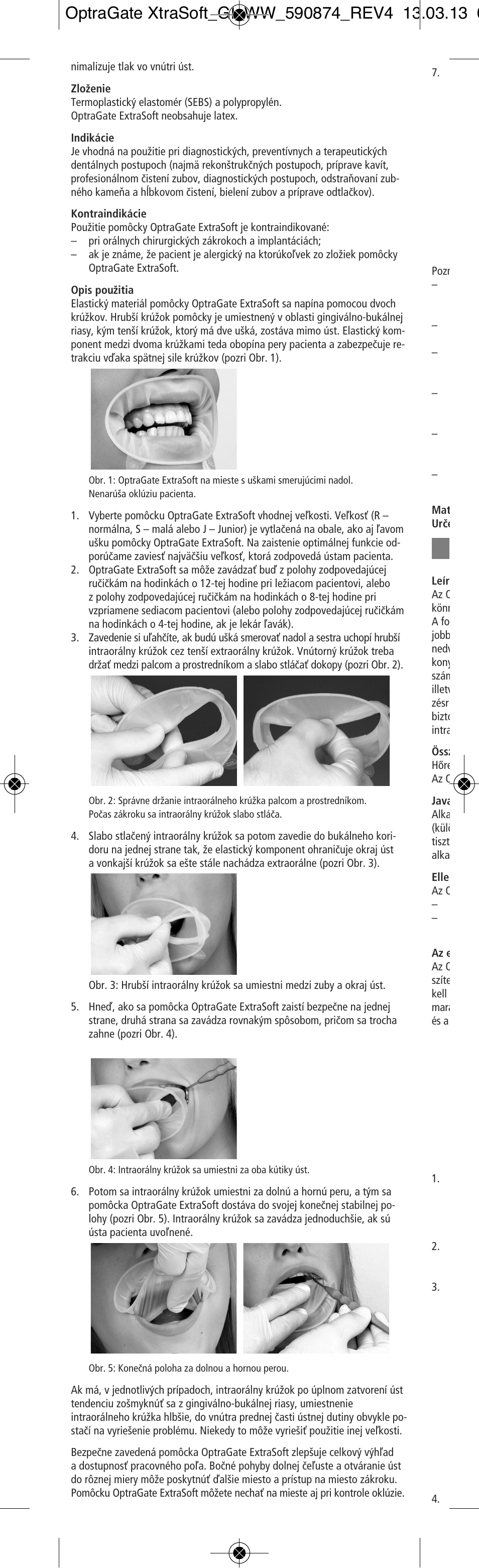 Ivoclar Vivadent OptraGate ExtraSoft Version User Manual | Page 26 / 48