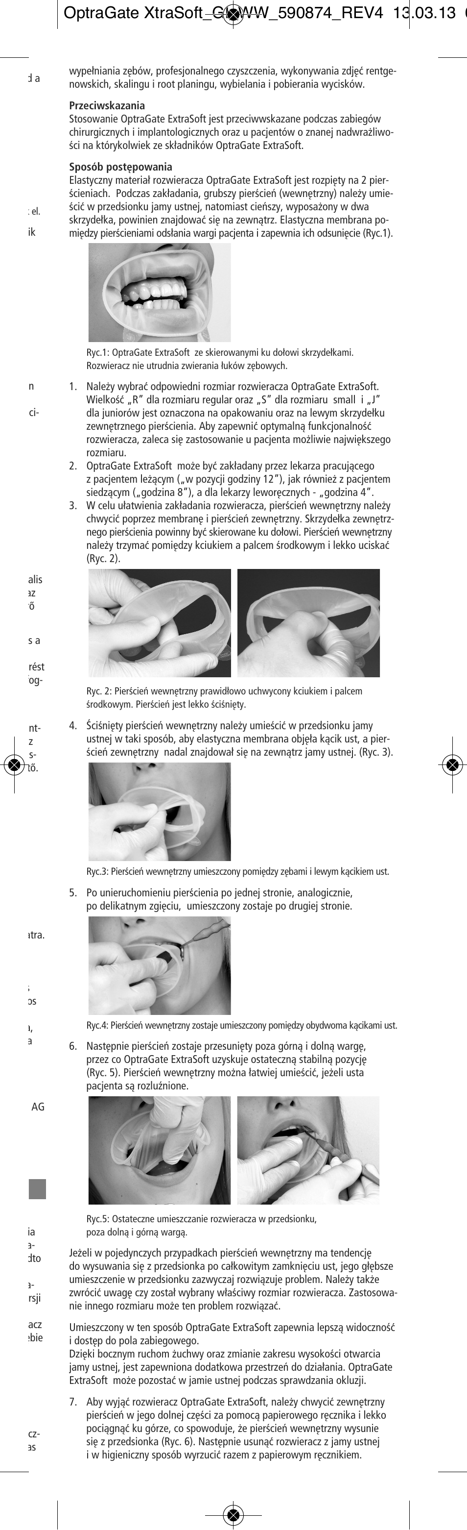 Ivoclar Vivadent OptraGate ExtraSoft Version User Manual | Page 29 / 48