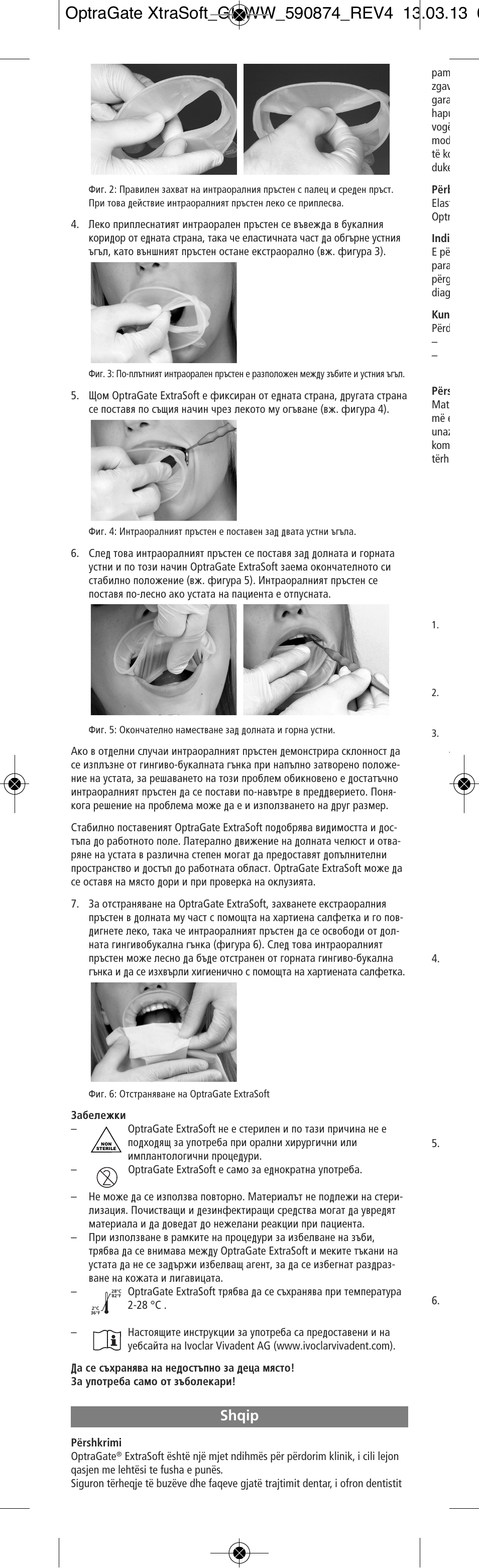 Shqip | Ivoclar Vivadent OptraGate ExtraSoft Version User Manual | Page 34 / 48