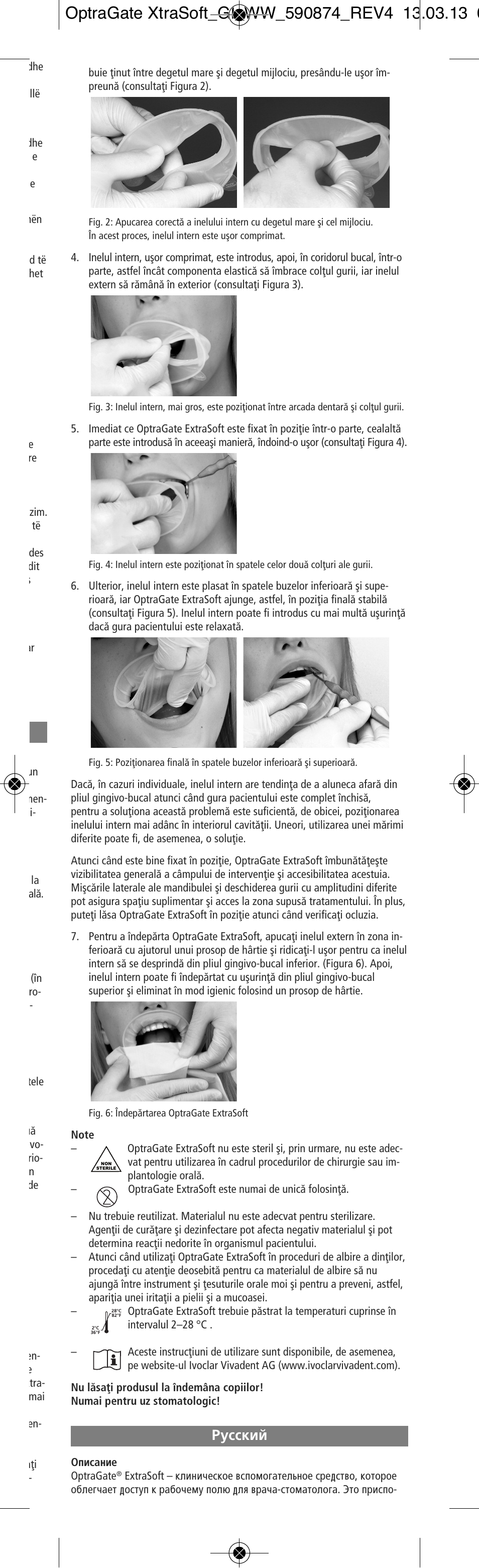 Russian, Êûòòíëè | Ivoclar Vivadent OptraGate ExtraSoft Version User Manual | Page 37 / 48