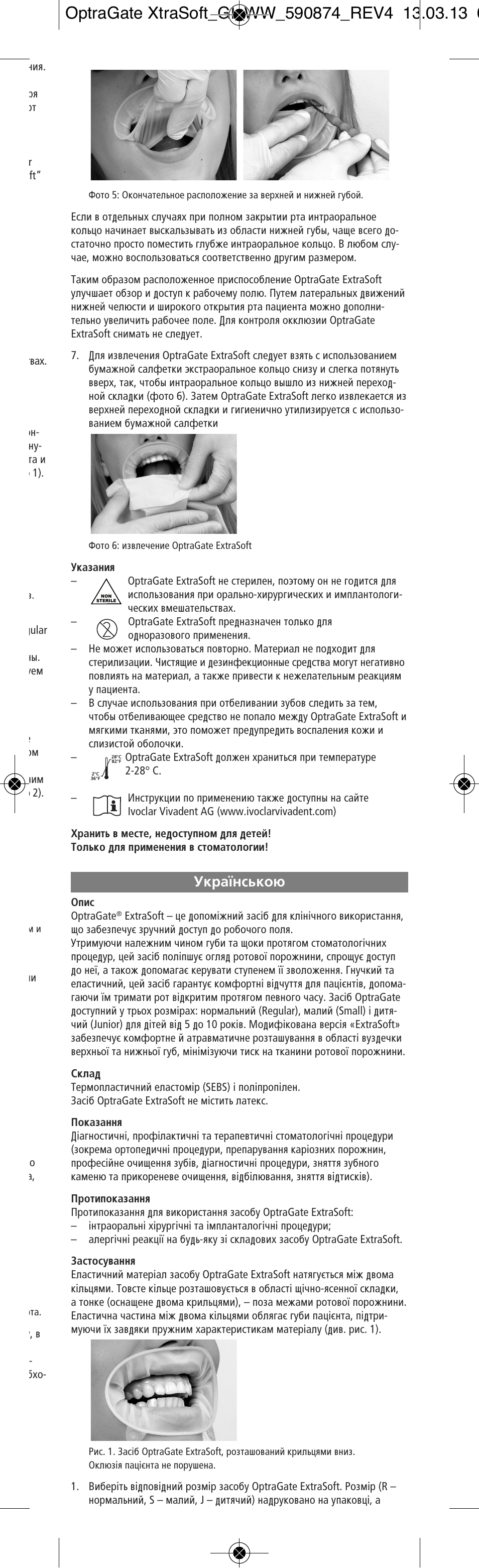 Ukranian, Ìí‡ªìò¸íó | Ivoclar Vivadent OptraGate ExtraSoft Version User Manual | Page 39 / 48