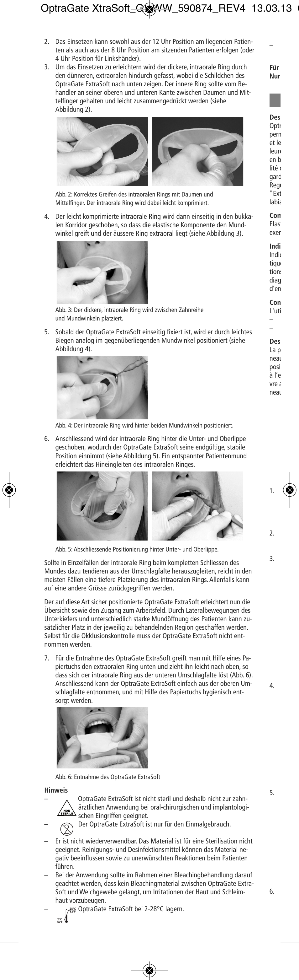 Ivoclar Vivadent OptraGate ExtraSoft Version User Manual | Page 4 / 48