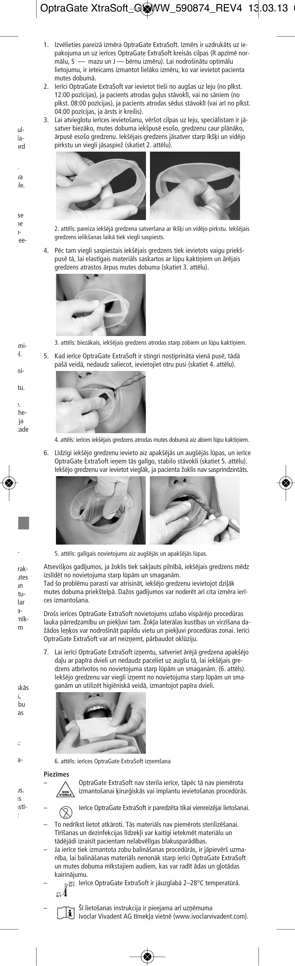 Ivoclar Vivadent OptraGate ExtraSoft Version User Manual | Page 43 / 48