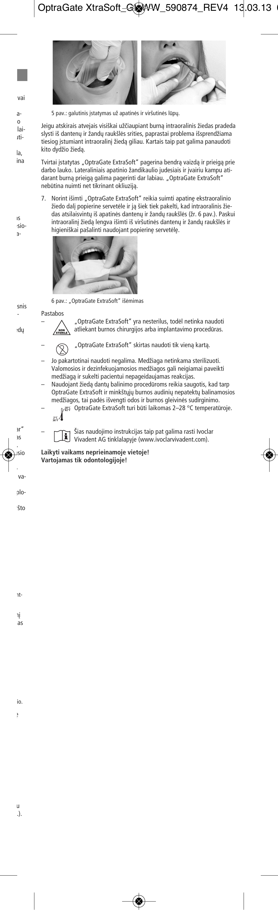 Ivoclar Vivadent OptraGate ExtraSoft Version User Manual | Page 45 / 48