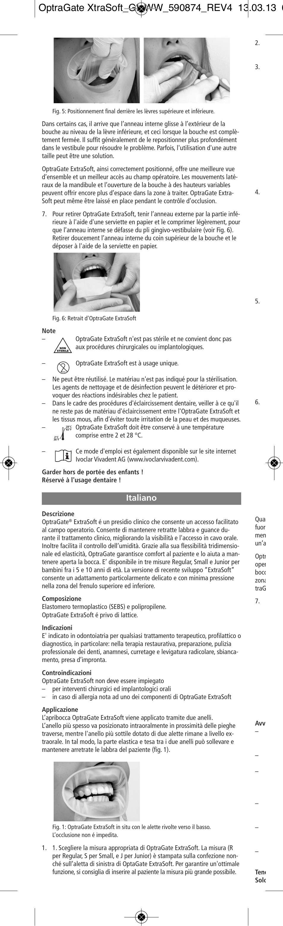 Italiano | Ivoclar Vivadent OptraGate ExtraSoft Version User Manual | Page 6 / 48