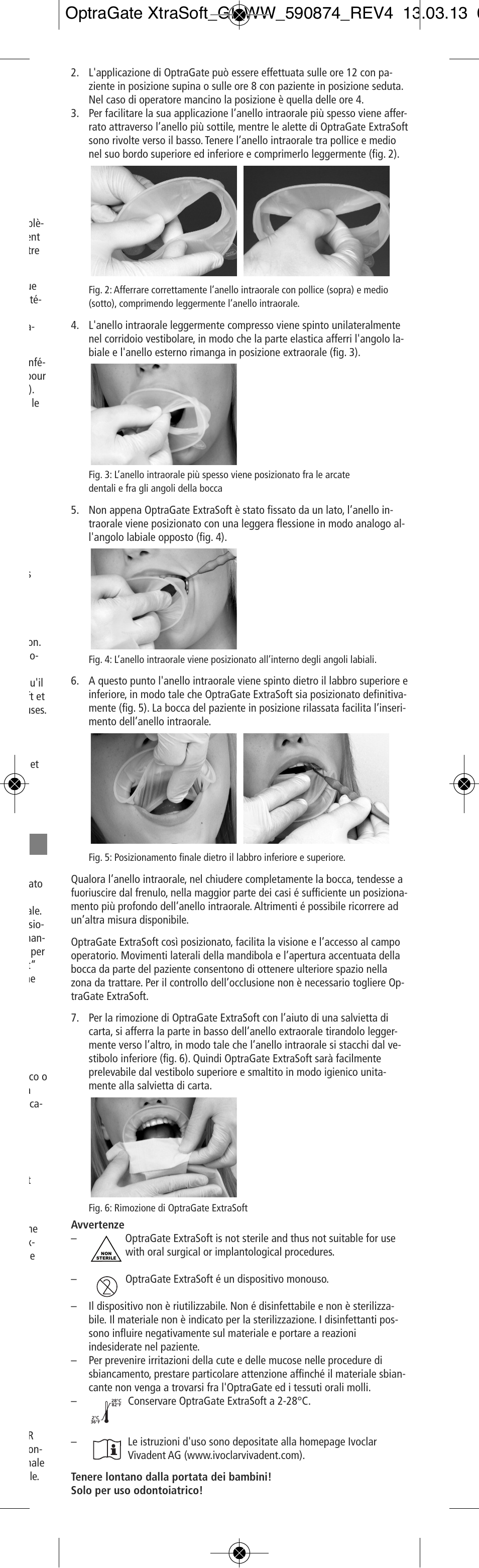 Ivoclar Vivadent OptraGate ExtraSoft Version User Manual | Page 7 / 48