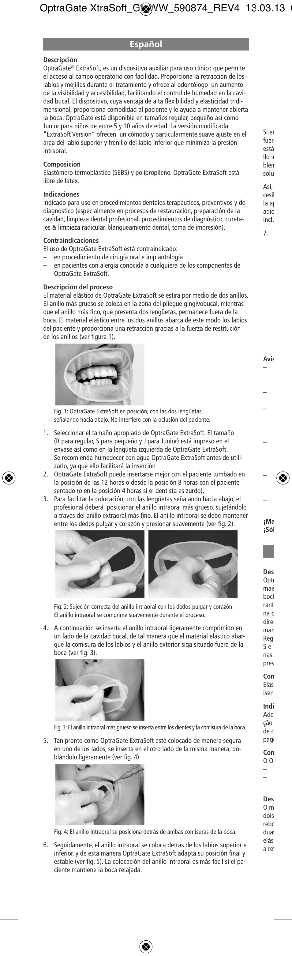 Español | Ivoclar Vivadent OptraGate ExtraSoft Version User Manual | Page 8 / 48