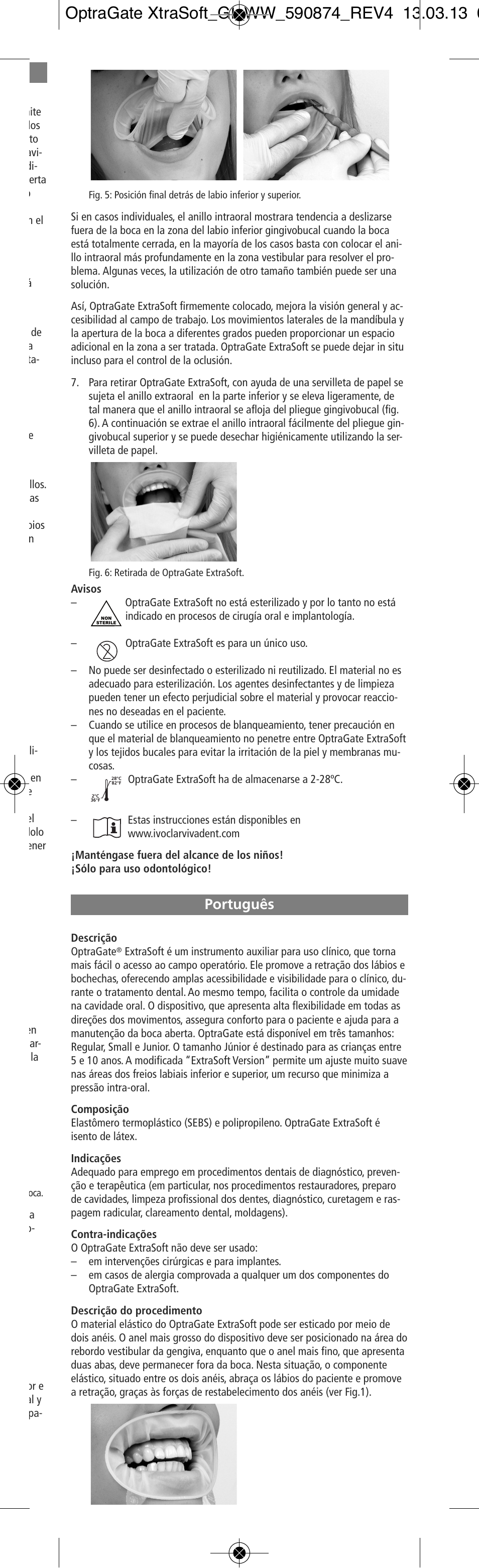 Português | Ivoclar Vivadent OptraGate ExtraSoft Version User Manual | Page 9 / 48