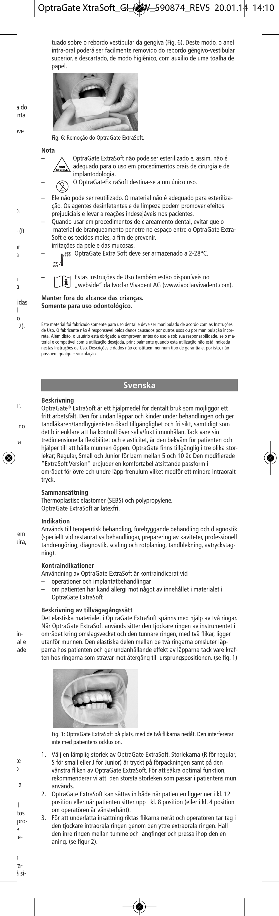 Svenska | Ivoclar Vivadent OptraGate ExtraSoft Version v.5 User Manual | Page 11 / 48