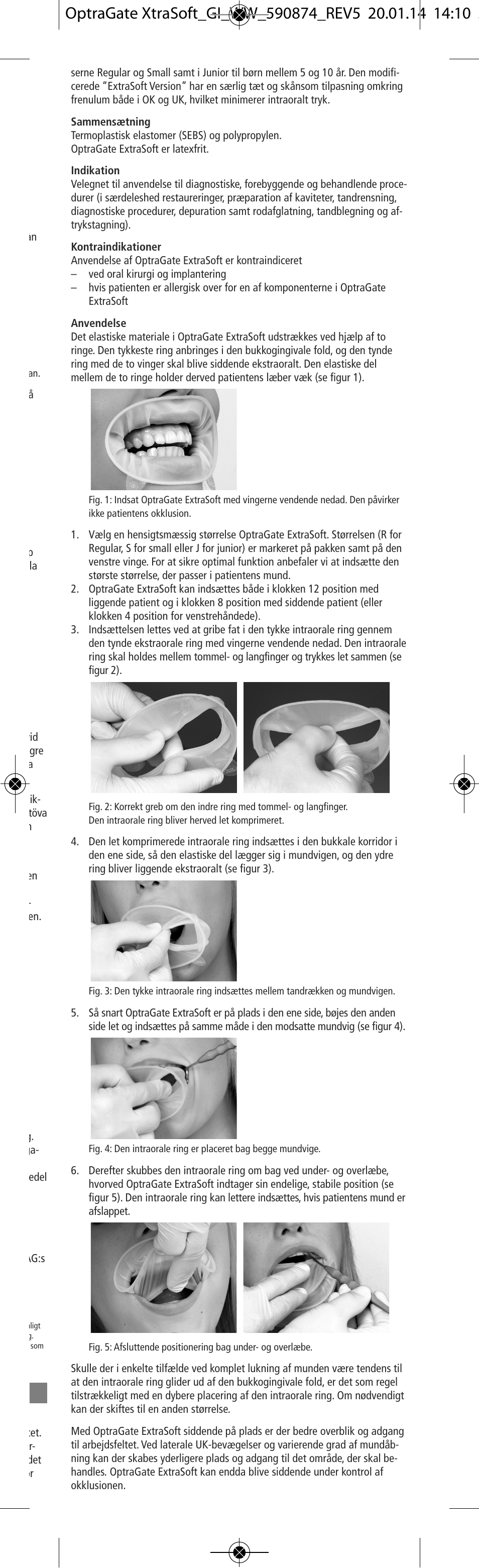 Ivoclar Vivadent OptraGate ExtraSoft Version v.5 User Manual | Page 13 / 48