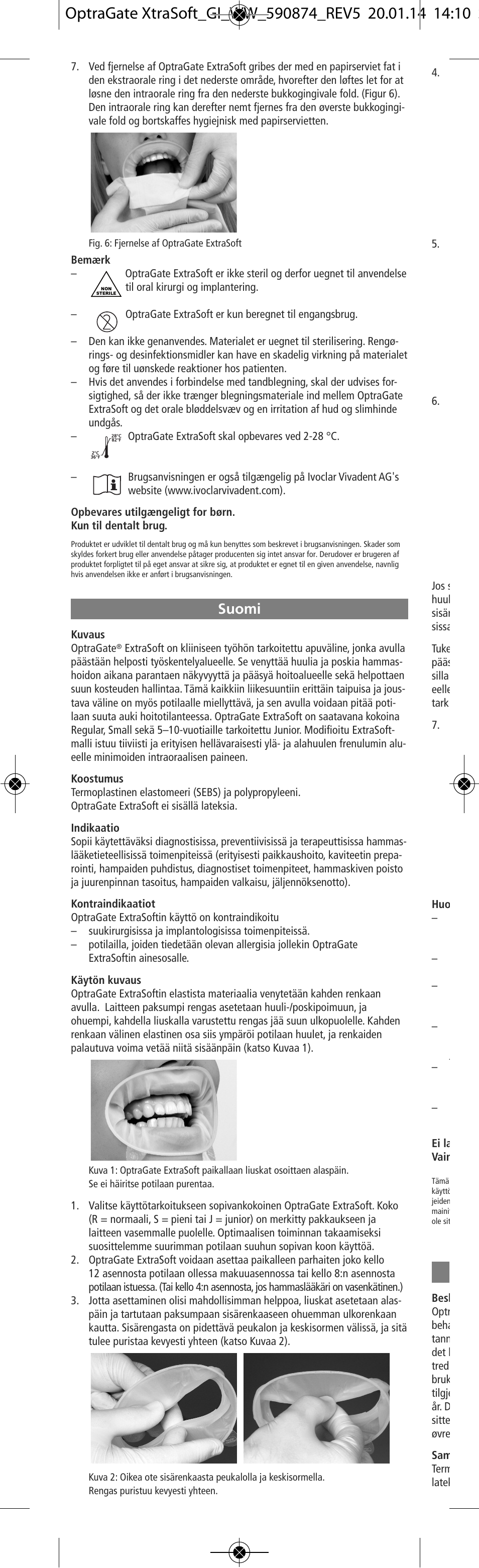 Suomi | Ivoclar Vivadent OptraGate ExtraSoft Version v.5 User Manual | Page 14 / 48