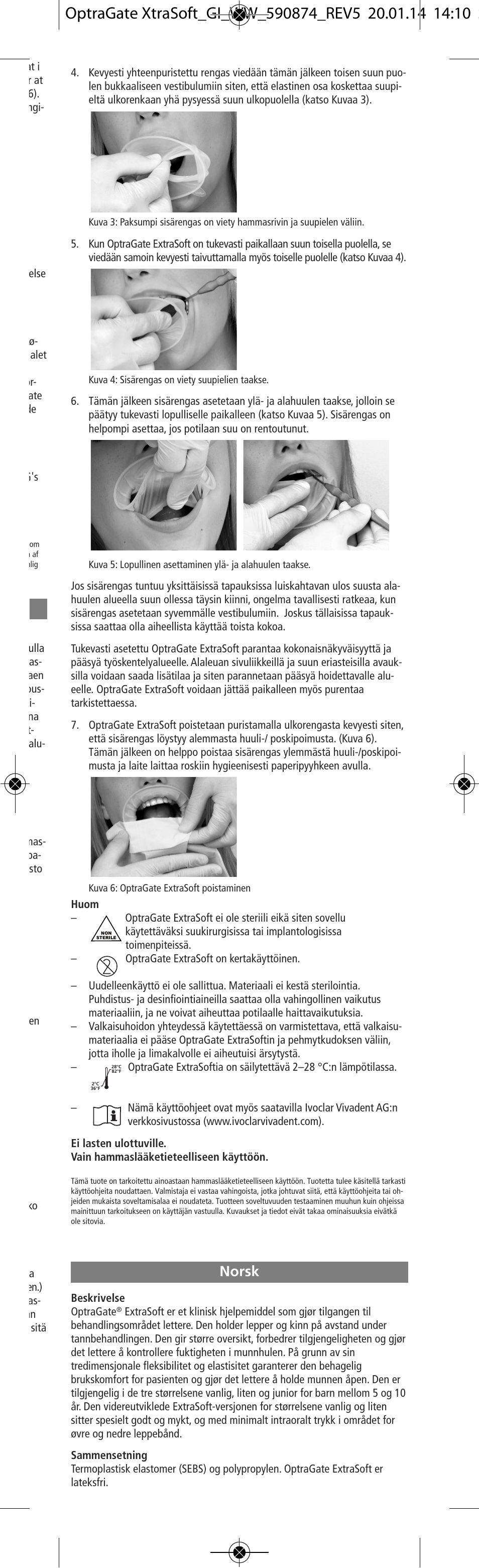 Norsk | Ivoclar Vivadent OptraGate ExtraSoft Version v.5 User Manual | Page 15 / 48