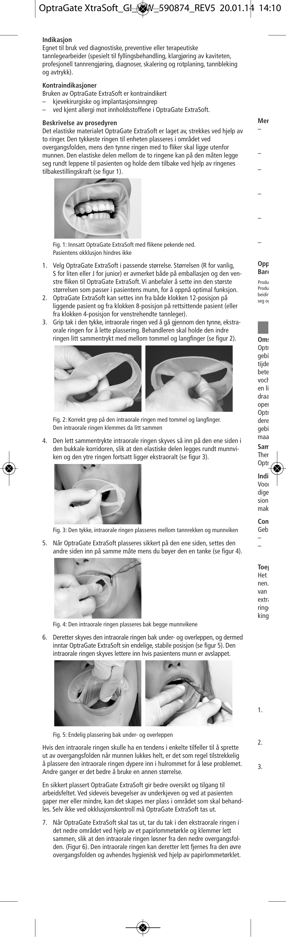 Ivoclar Vivadent OptraGate ExtraSoft Version v.5 User Manual | Page 16 / 48