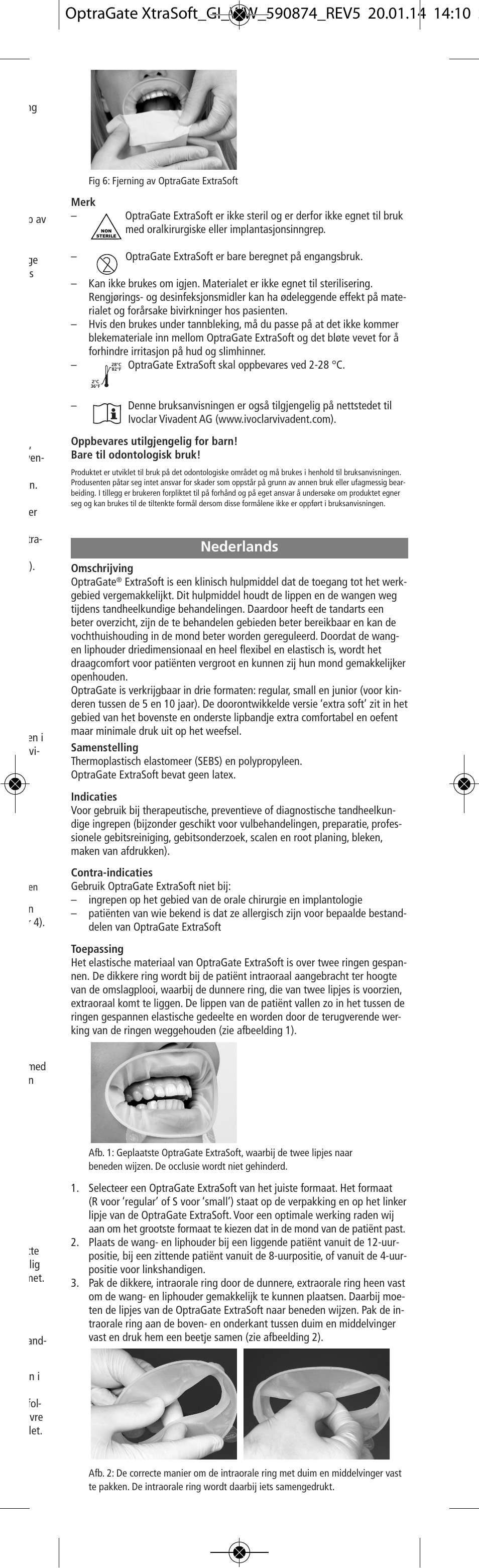 Nederlands | Ivoclar Vivadent OptraGate ExtraSoft Version v.5 User Manual | Page 17 / 48