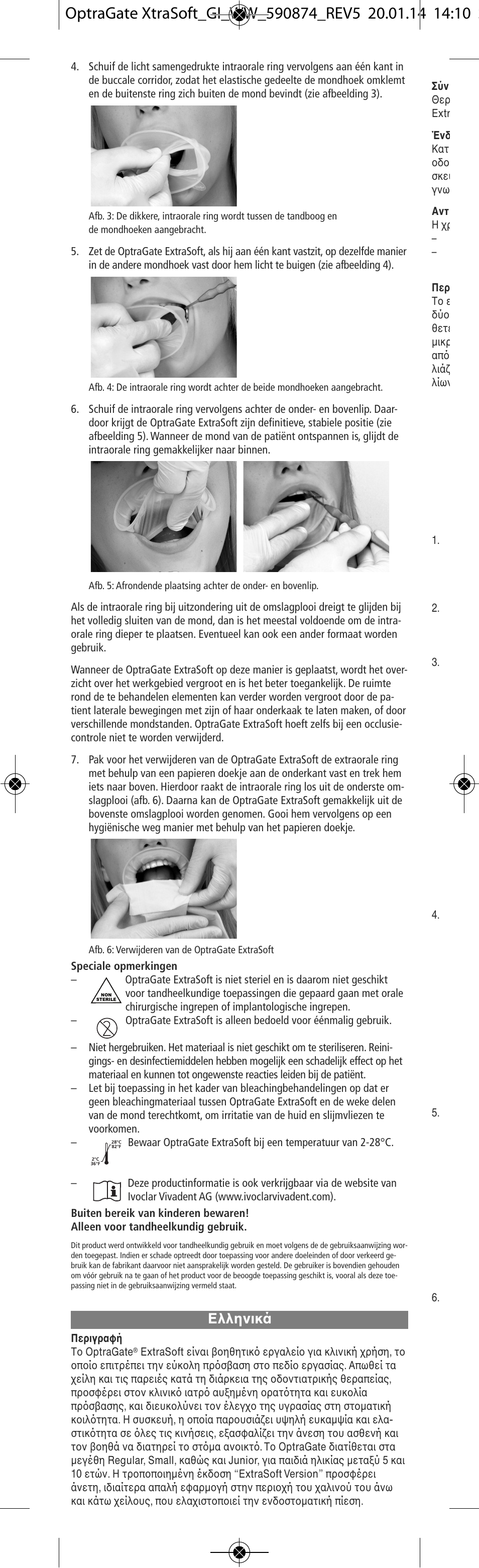 Ελληνικά | Ivoclar Vivadent OptraGate ExtraSoft Version v.5 User Manual | Page 18 / 48