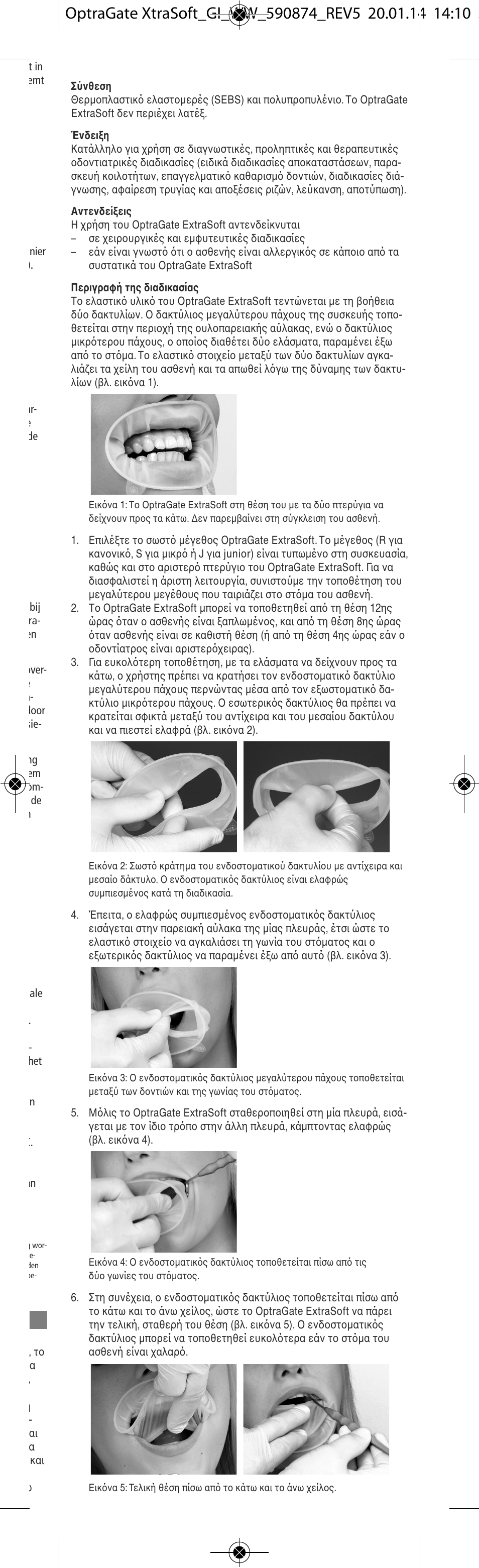 Ivoclar Vivadent OptraGate ExtraSoft Version v.5 User Manual | Page 19 / 48