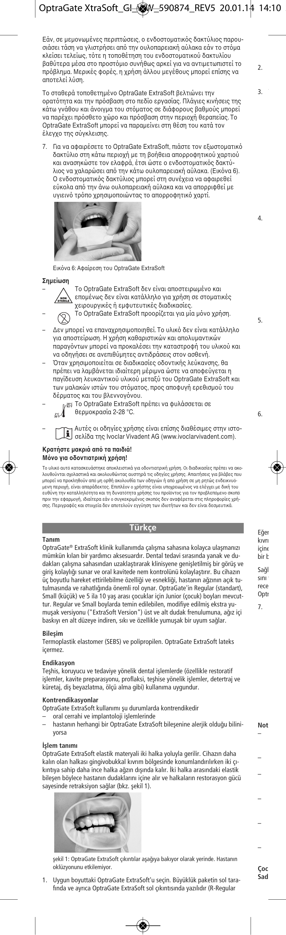 Türkçe | Ivoclar Vivadent OptraGate ExtraSoft Version v.5 User Manual | Page 20 / 48