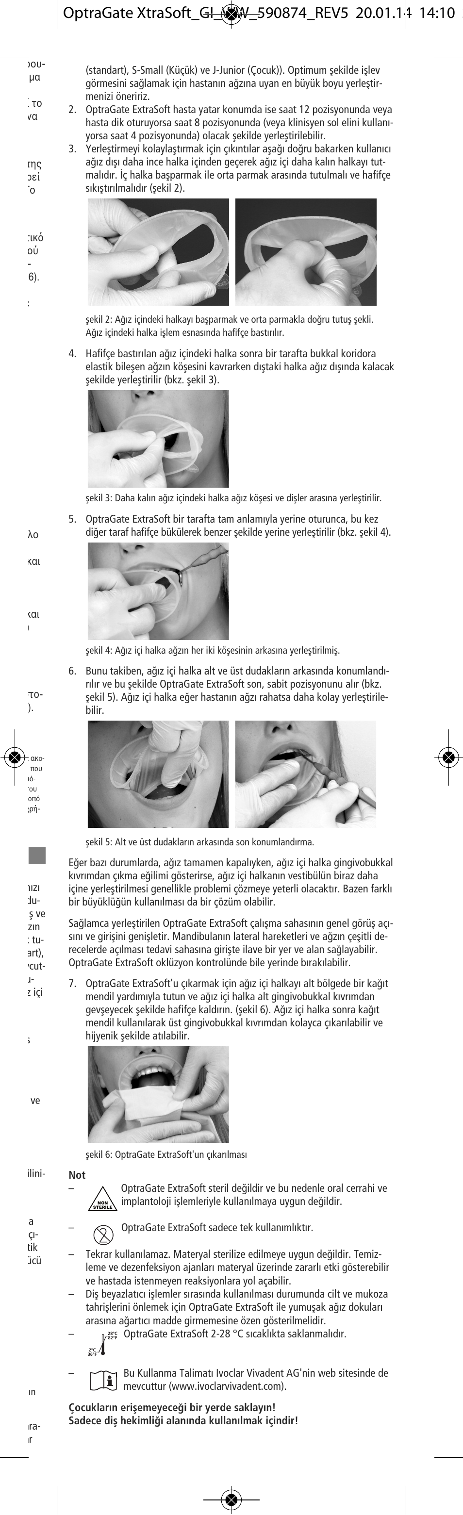 Ivoclar Vivadent OptraGate ExtraSoft Version v.5 User Manual | Page 21 / 48