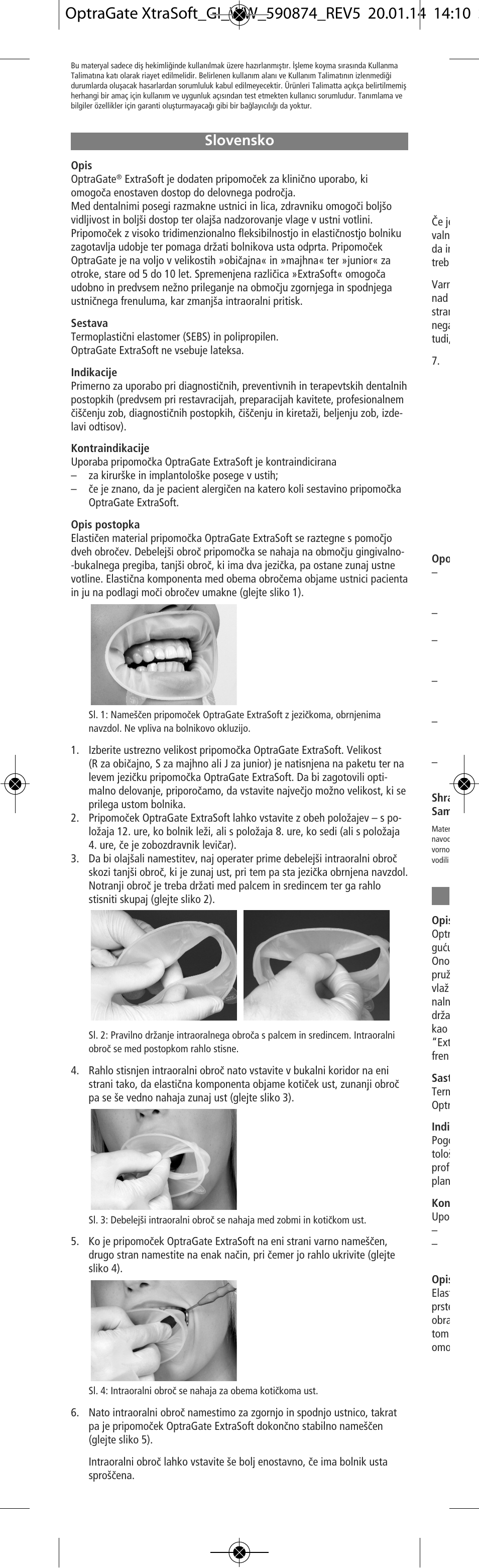 Slovensko | Ivoclar Vivadent OptraGate ExtraSoft Version v.5 User Manual | Page 22 / 48