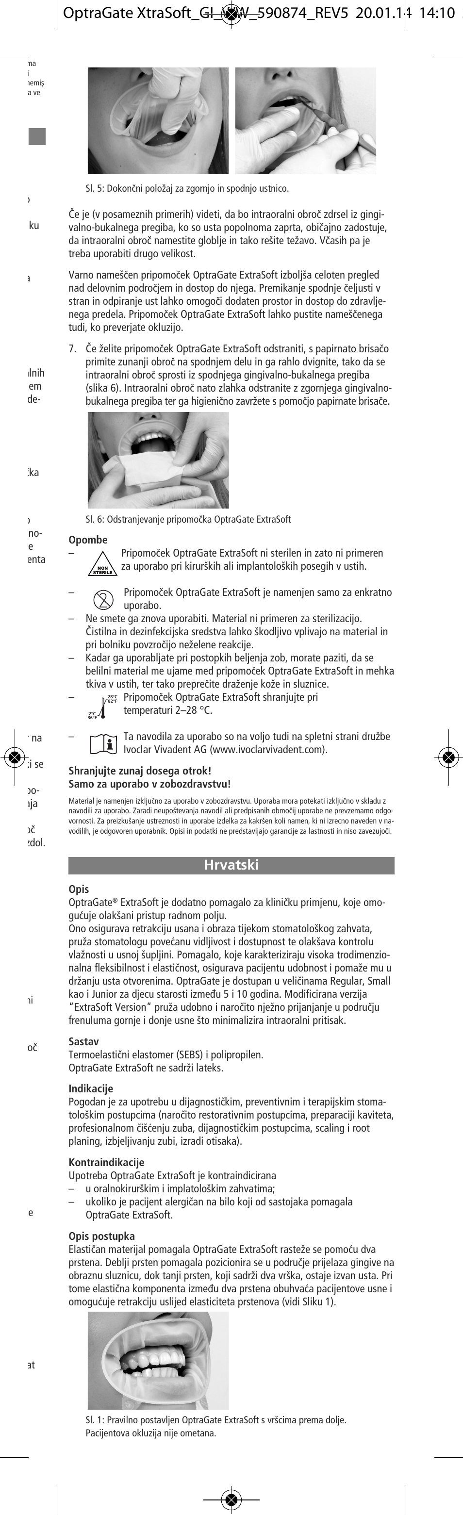 Hrvatski | Ivoclar Vivadent OptraGate ExtraSoft Version v.5 User Manual | Page 23 / 48