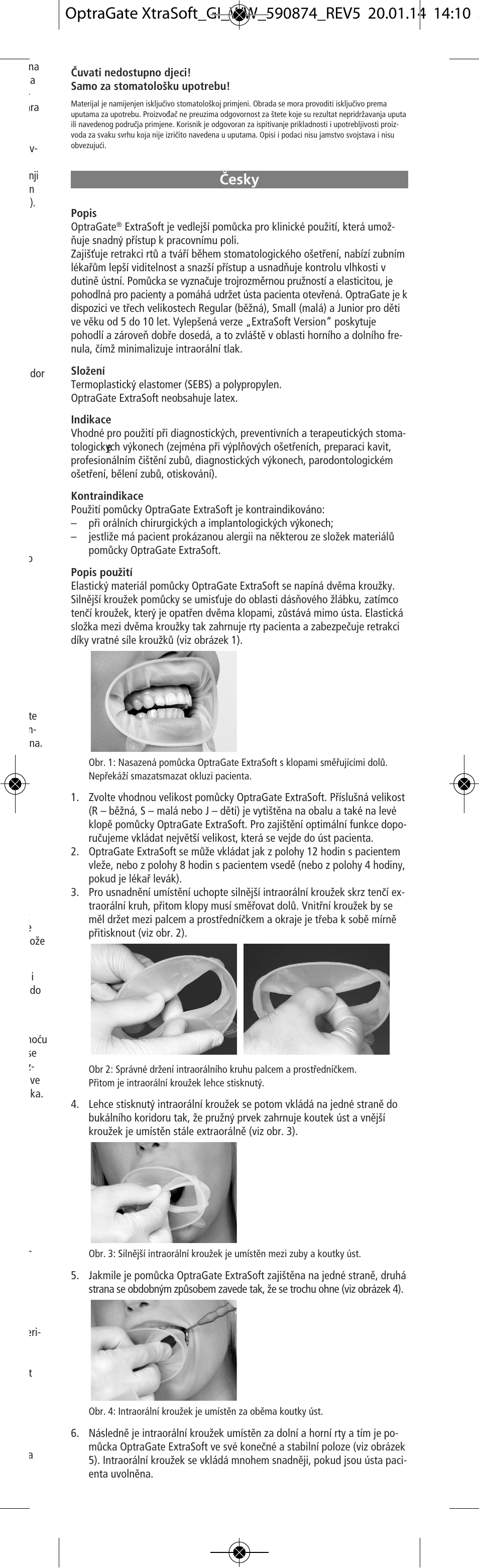 Cesky, Âesky | Ivoclar Vivadent OptraGate ExtraSoft Version v.5 User Manual | Page 25 / 48