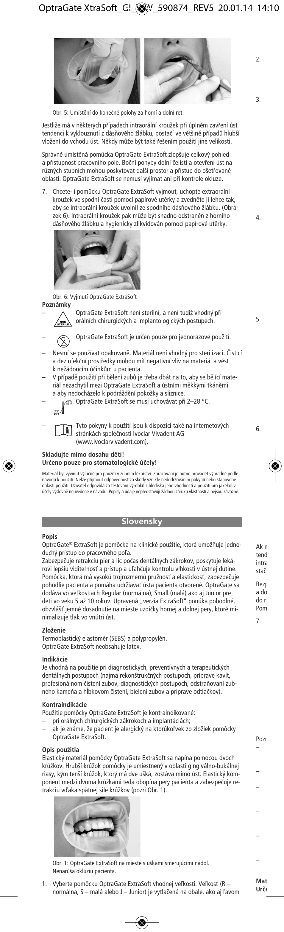 Slovensky | Ivoclar Vivadent OptraGate ExtraSoft Version v.5 User Manual | Page 26 / 48