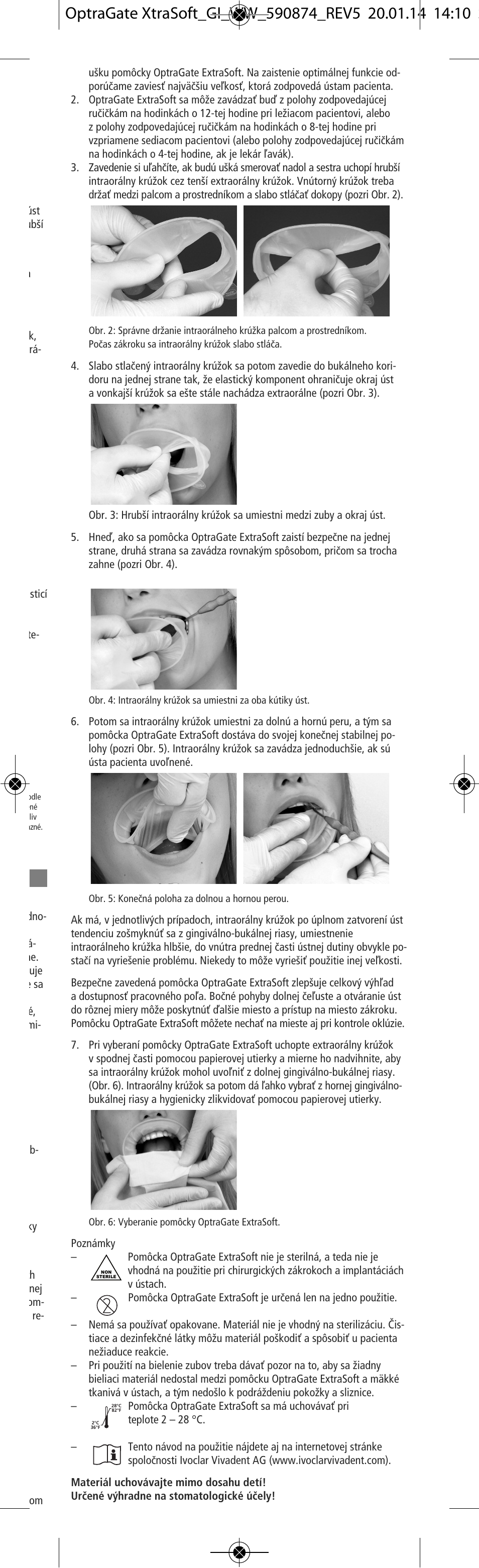 Ivoclar Vivadent OptraGate ExtraSoft Version v.5 User Manual | Page 27 / 48