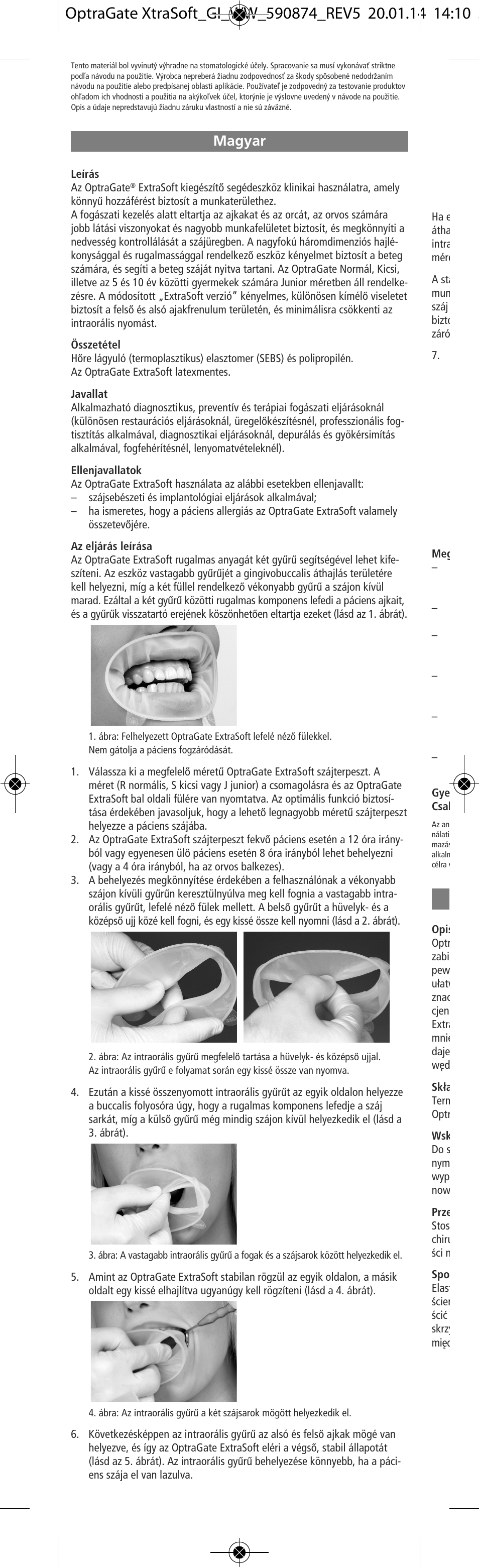 Magyar | Ivoclar Vivadent OptraGate ExtraSoft Version v.5 User Manual | Page 28 / 48